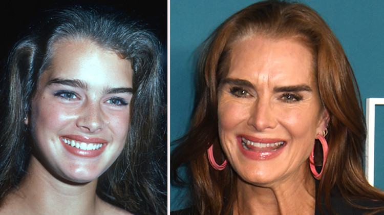Brooke Shields: Güzelliğin Gerçek Anlamı ve Estetik Tercihleri